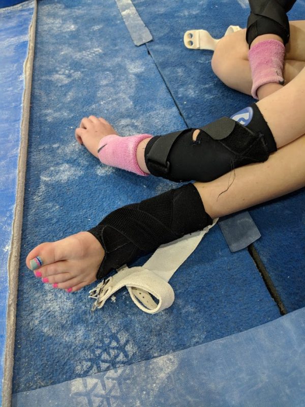 A gymnasts's injured elbow and ankle, both braced, shown on a chalky floor.